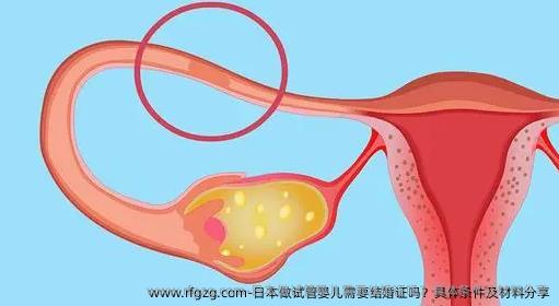 日本做代孕需要结婚证吗？具体条件及材料分享