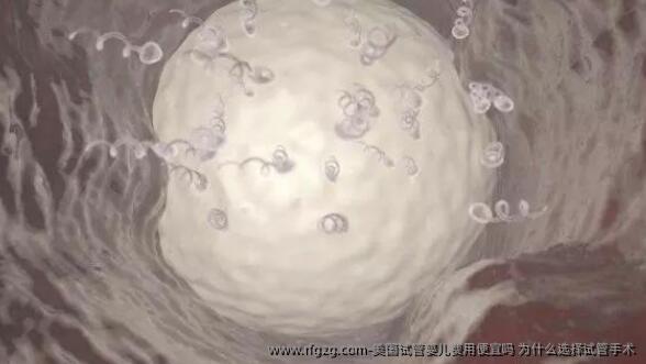 美国代孕费用便宜吗 为什么选择试管手术