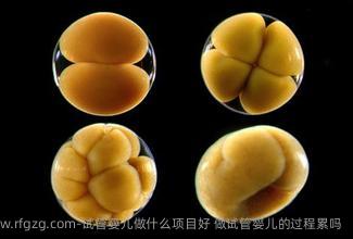 代孕做什么项目好 做代孕的过程累吗